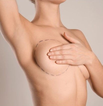 Sagging Breast Skin Needs Breast Lift